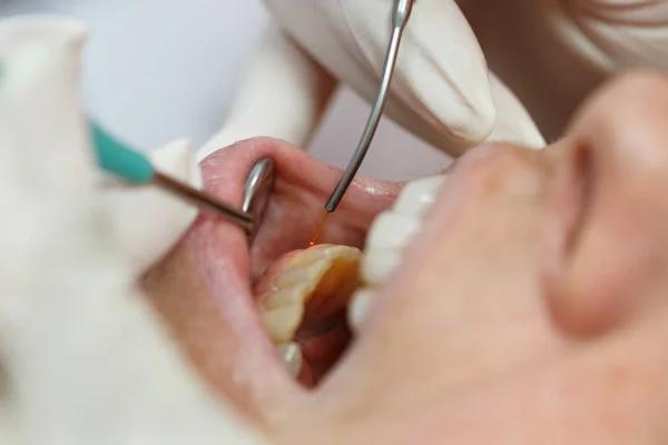 The Role of Laser Dentistry in Implant Recovery and Oral Health