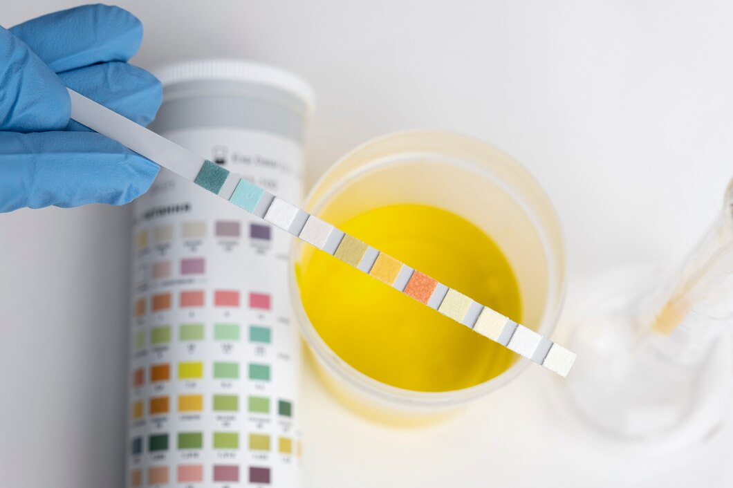 Using Fake Pee to Beat a Drug Test May Be Easier Than You Think